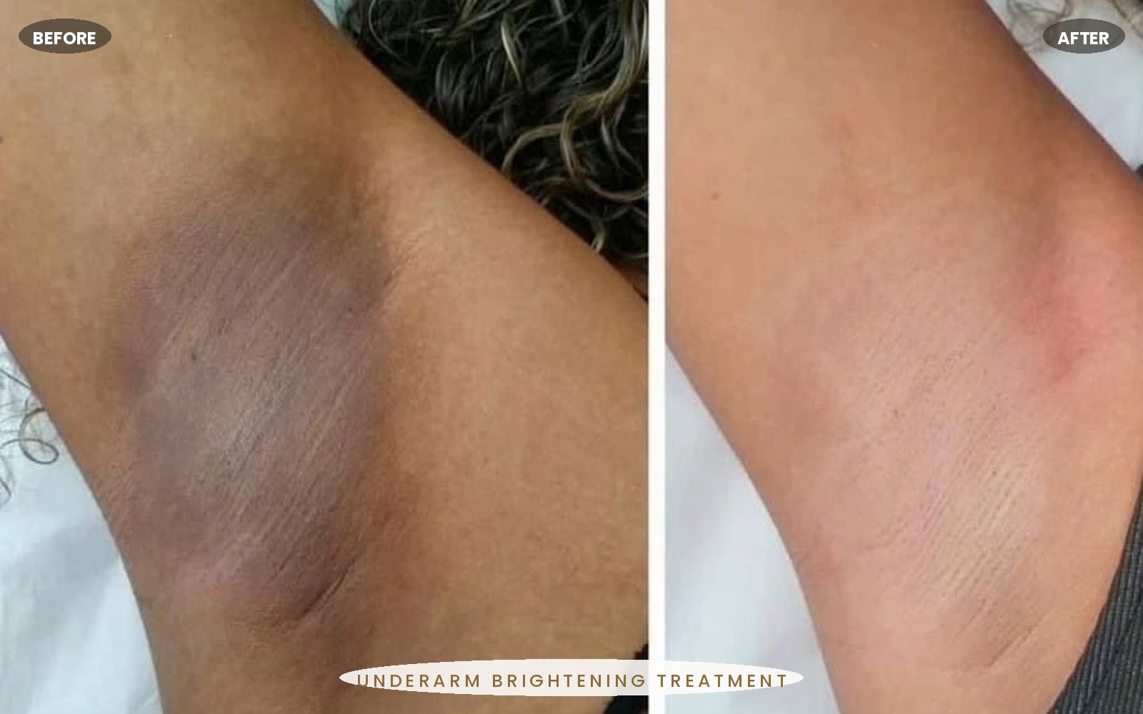 Roseluxe treatment 9